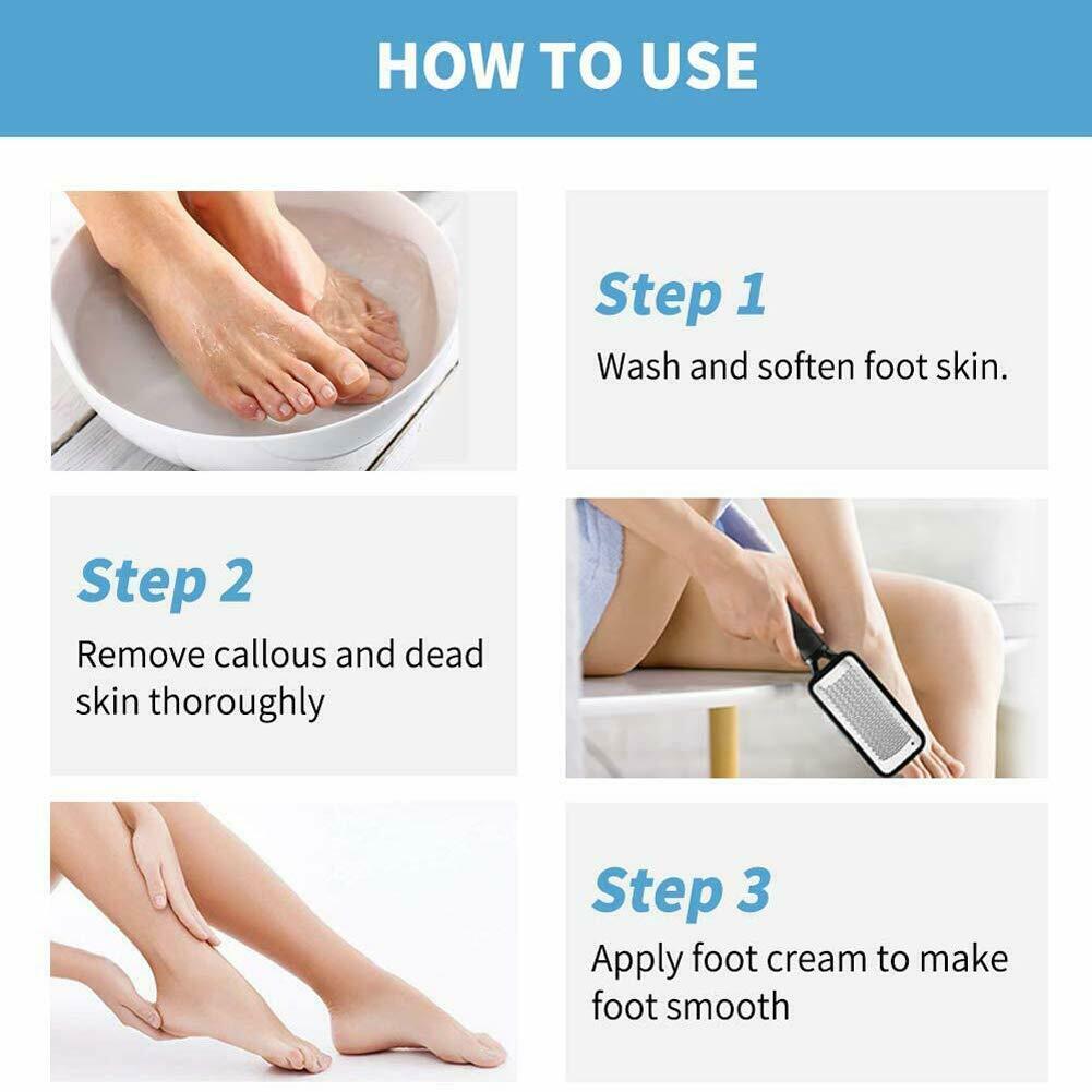 Professional Foot Callus Remover for Effortless Pedicures