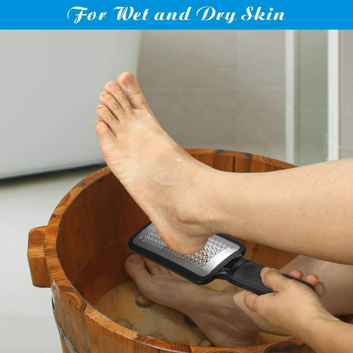 Professional Foot Callus Remover for Effortless Pedicures