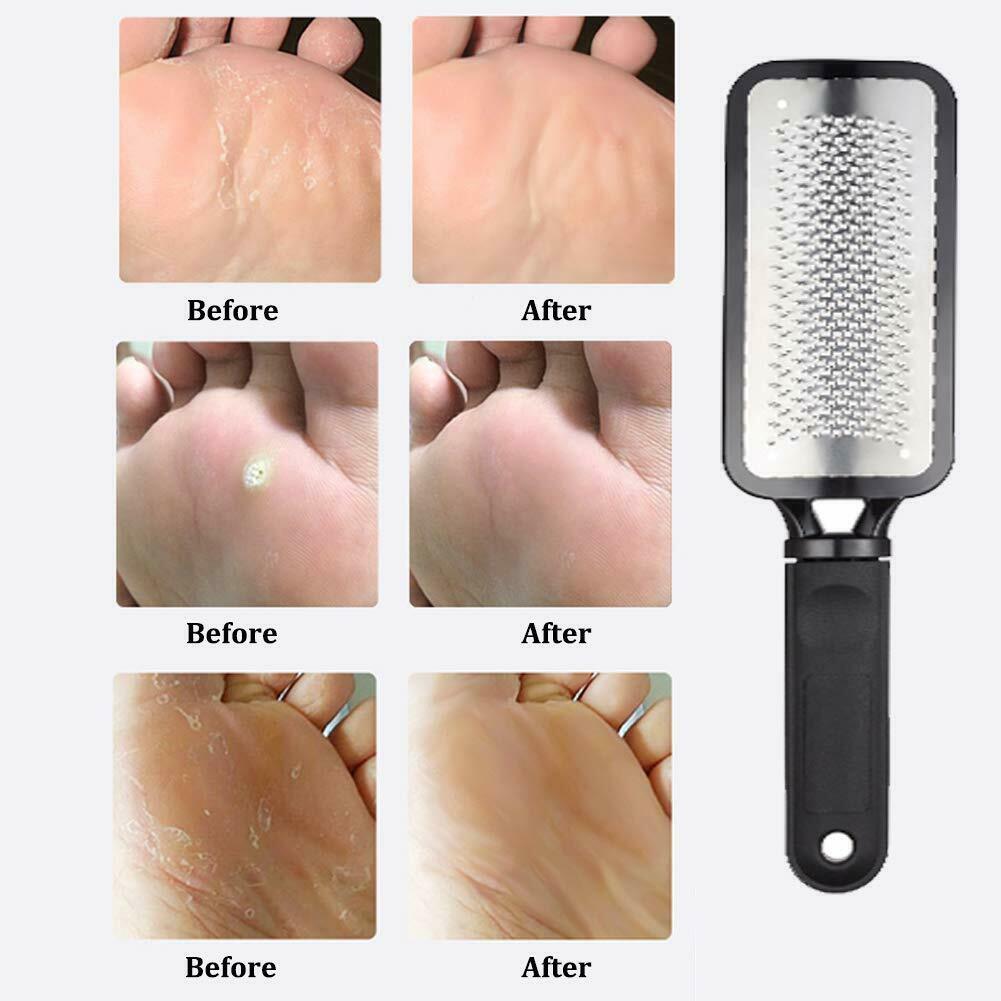 Professional Foot Callus Remover for Effortless Pedicures